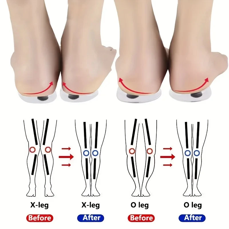 Women Shoes Types - 男性と女性のための整形外科用靴,足,o/x脚タイプ,外反母趾矯正用,シリコンゲル,磁気マッサージ,1ペア