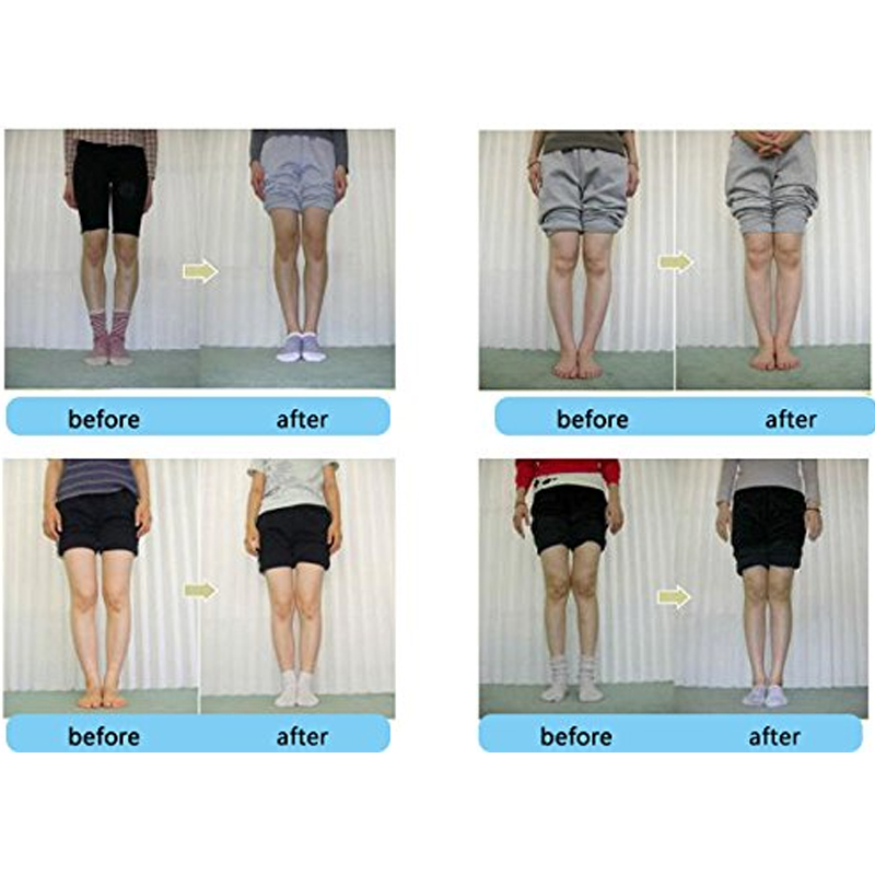 Tcare-男性と女性のための整形外科用靴の中敷き,内側と外 - Women Shoes Types のレビューと価格